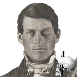 Phineas Gage -  36 Years Old(histoire-universelle)