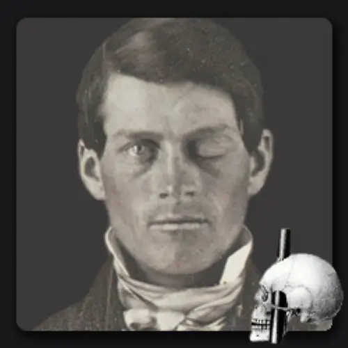 Phineas Gage Phineas Gage
