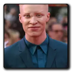 Toutes les infos sur Albino Albino (american-horror-story_2011)